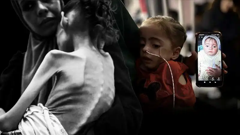 Küçük Meryem’in Açlıkla Mücadelesi: 25 Kilodan 10 Kiloya Düşen Bir Çocuk