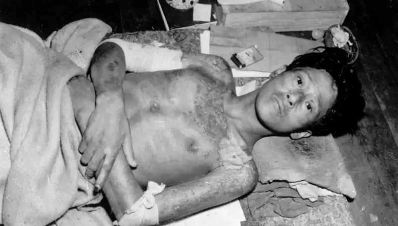 80 Yıl Sonra Nagasaki'den Korkutucu Bir Uyarı: Nükleer Tehdit Yeniden Gündemde!